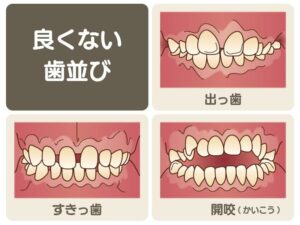 良くない歯並び
