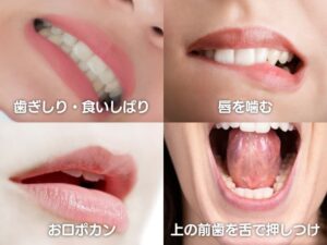 歯に負担をかける習慣