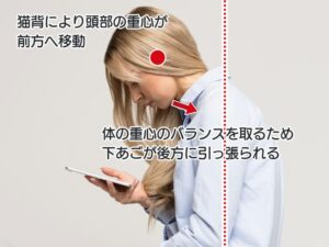 悪い姿勢でスマートフォンを操作する女性