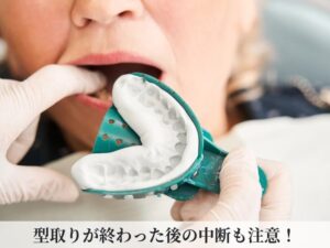 型取りの様子