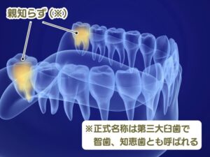親知らず