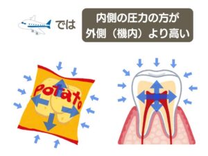 気圧性歯