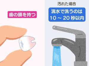 抜けた歯の取り扱い