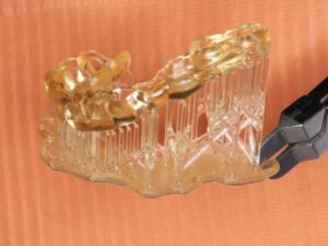 3Dプリンタで作成したインプラント