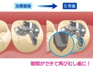 治療後と5年後の比較