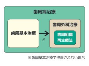 歯周病治療の流れ