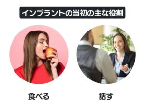 インプラントの当初の主な役割