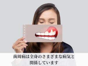 歯周病の女性