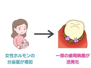 妊娠中のホルモンの影響