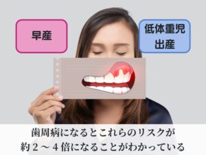 妊娠中の歯周病のリスク