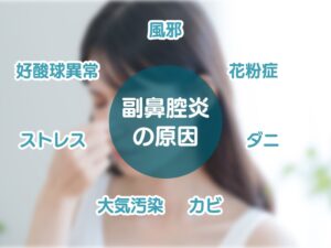 副鼻腔炎の原因